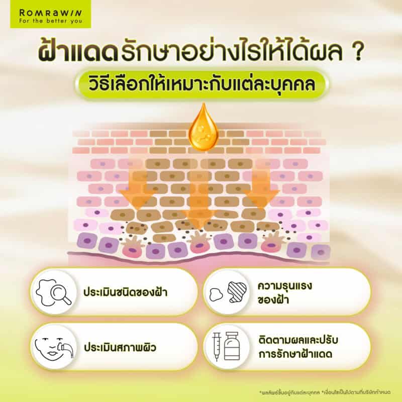 รักษาฝ้าแดดอย่างไรให้ได้ผล? วิธีเลือกให้เหมาะกับแต่ละบุคคล