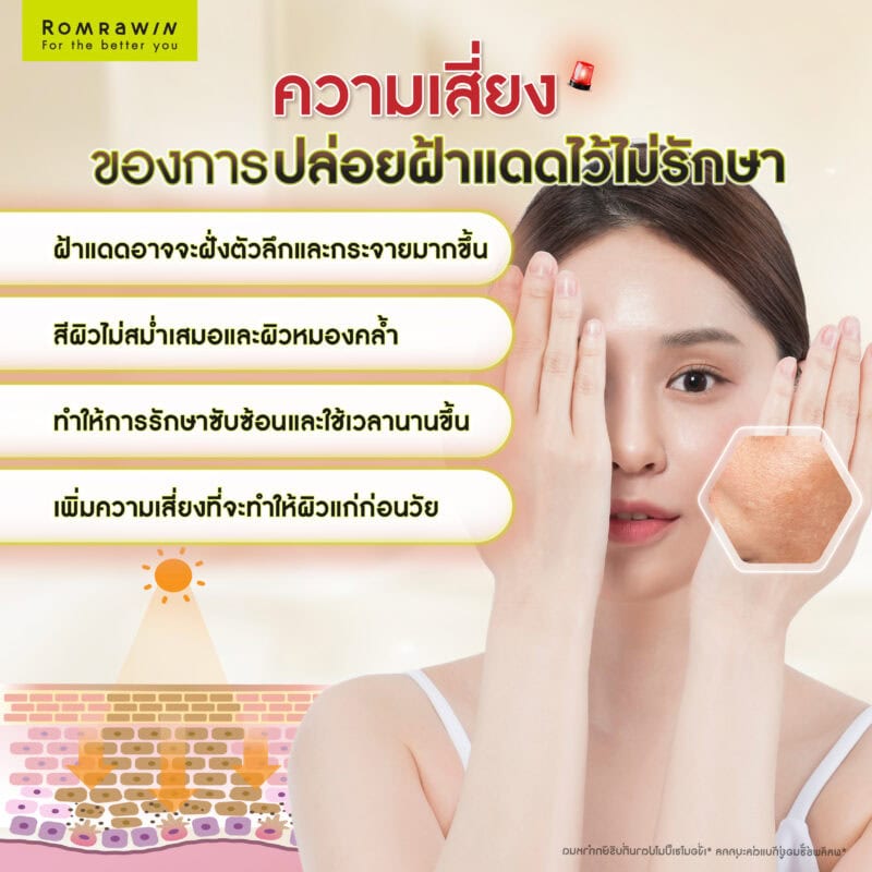 ความเสี่ยงของการปล่อยฝ้าแดดไว้ไม่รักษา