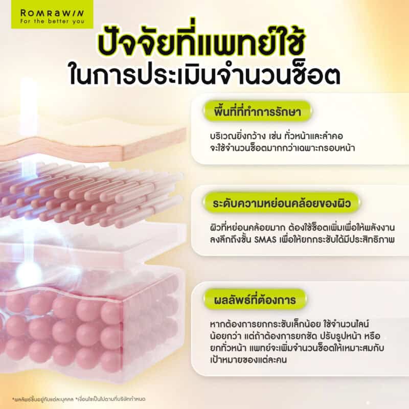 ดึงหน้าไม่ผ่าตัด ด้วย Ultherapy Prime ปัจจัยที่แพทย์ใช้ในการประเมินจำนวนช็อต (Line)