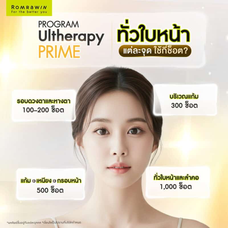 ดึงหน้าไม่ผ่าตัด ด้วย Ultherapy PRIME ทั่วใบหน้า แต่ละจุดใช้กี่ช็อต (Line)?