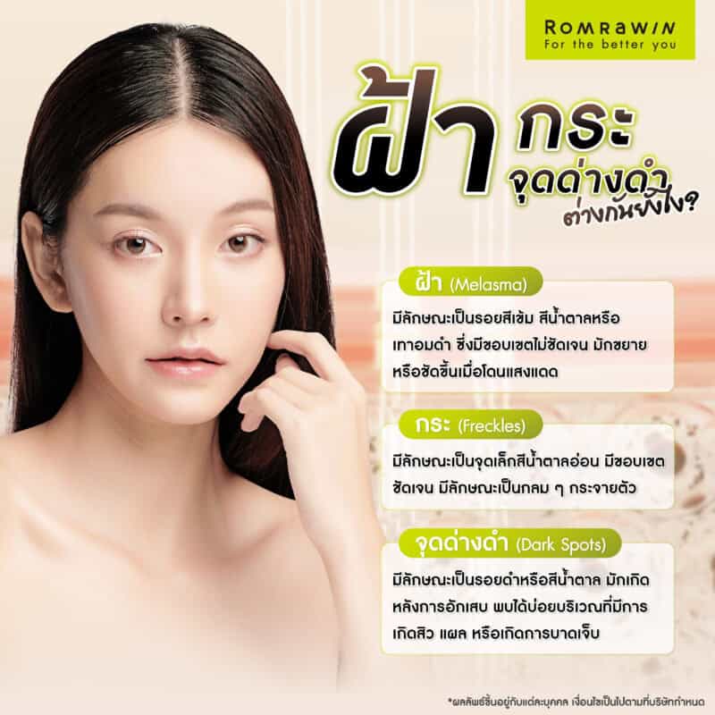 ฝ้า กระ จุดด่างดำมีลักษณะต่างกันอย่างไร ? ดูอย่างไรว่าเรามีปัญหาผิวแบบใด