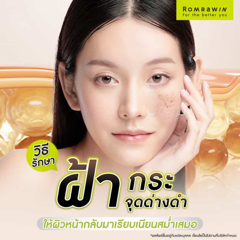 วิธีรักษาฝ้า กระ จุดด่างดำ ให้ผิวหน้ากลับมาเรียบเนียนสม่ำเสมอ