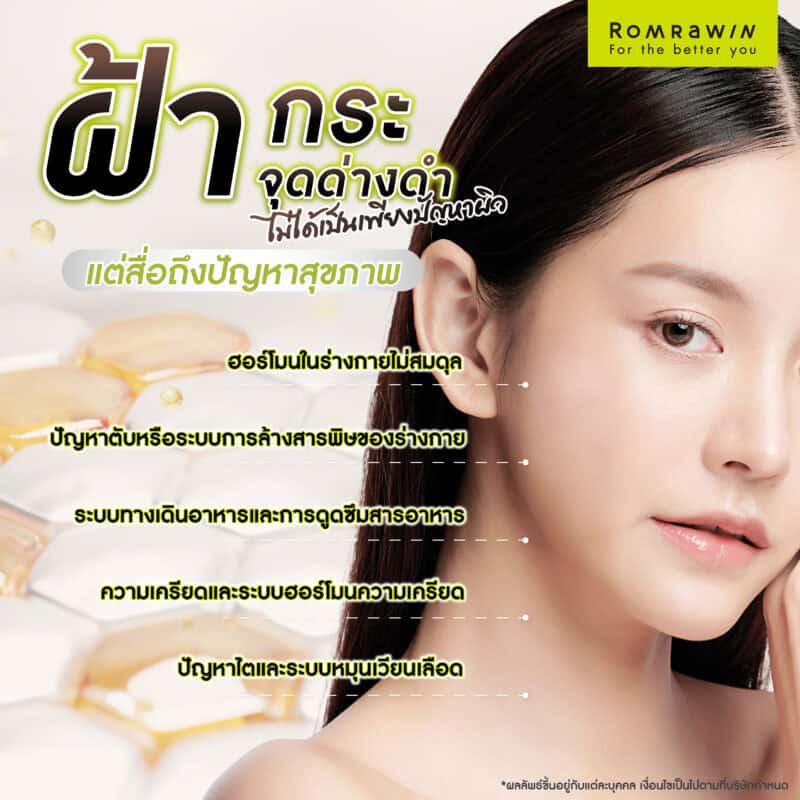 ฝ้า กระ จุดด่างดำ ไม่ได้เป็นเพียงปัญหาผิว แต่สื่อถึงปัญหาสุขภาพ