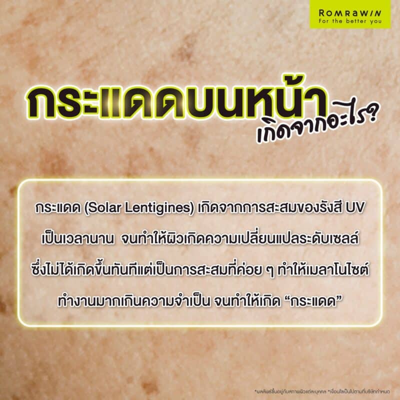 กระแดดบนใบหน้าเกิดจากอะไร ? 