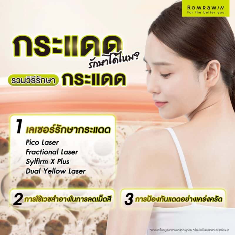 กระแดดรักษาได้ไหม ? รวมวิธีรักษากระแดด