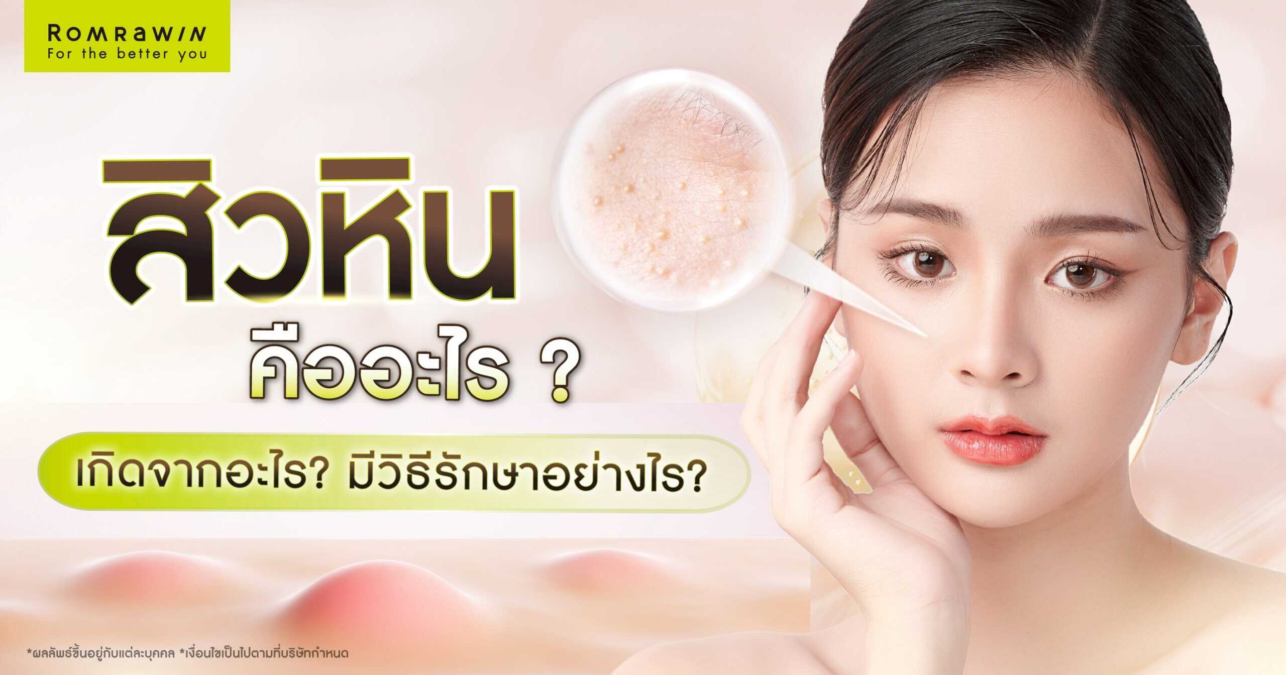 สิวหินคืออะไร