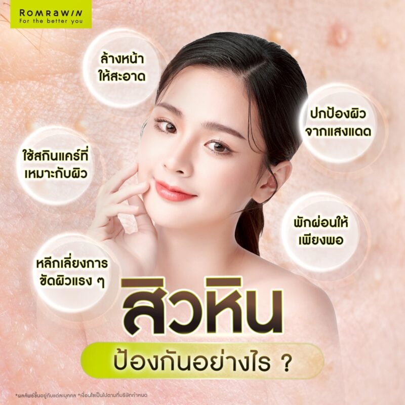 สิวหินป้องกันอย่างไร?