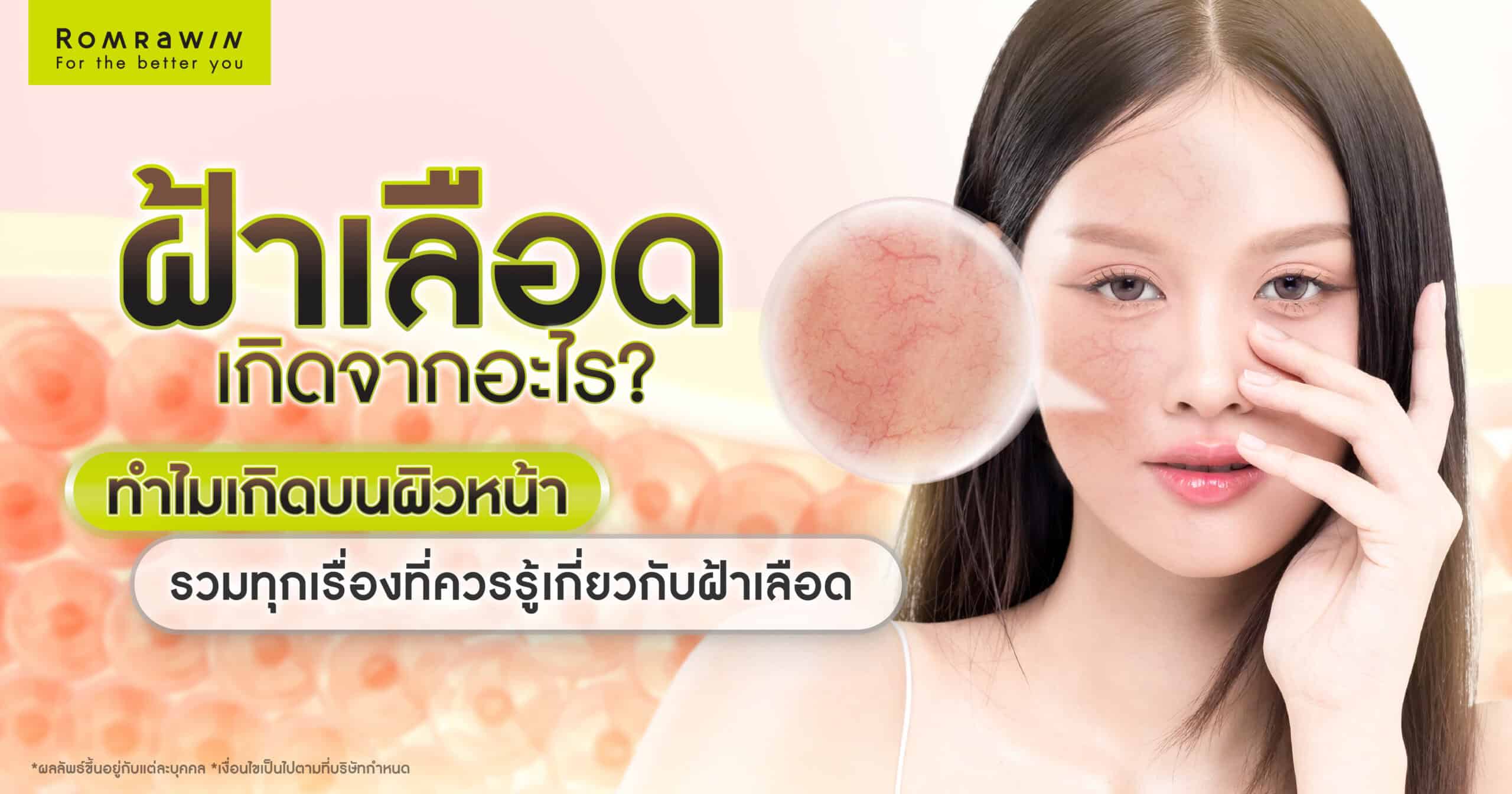 ฝ้าเลือดเกิดจากอะไร ? รักษาแบบไหนไม่อันตราย