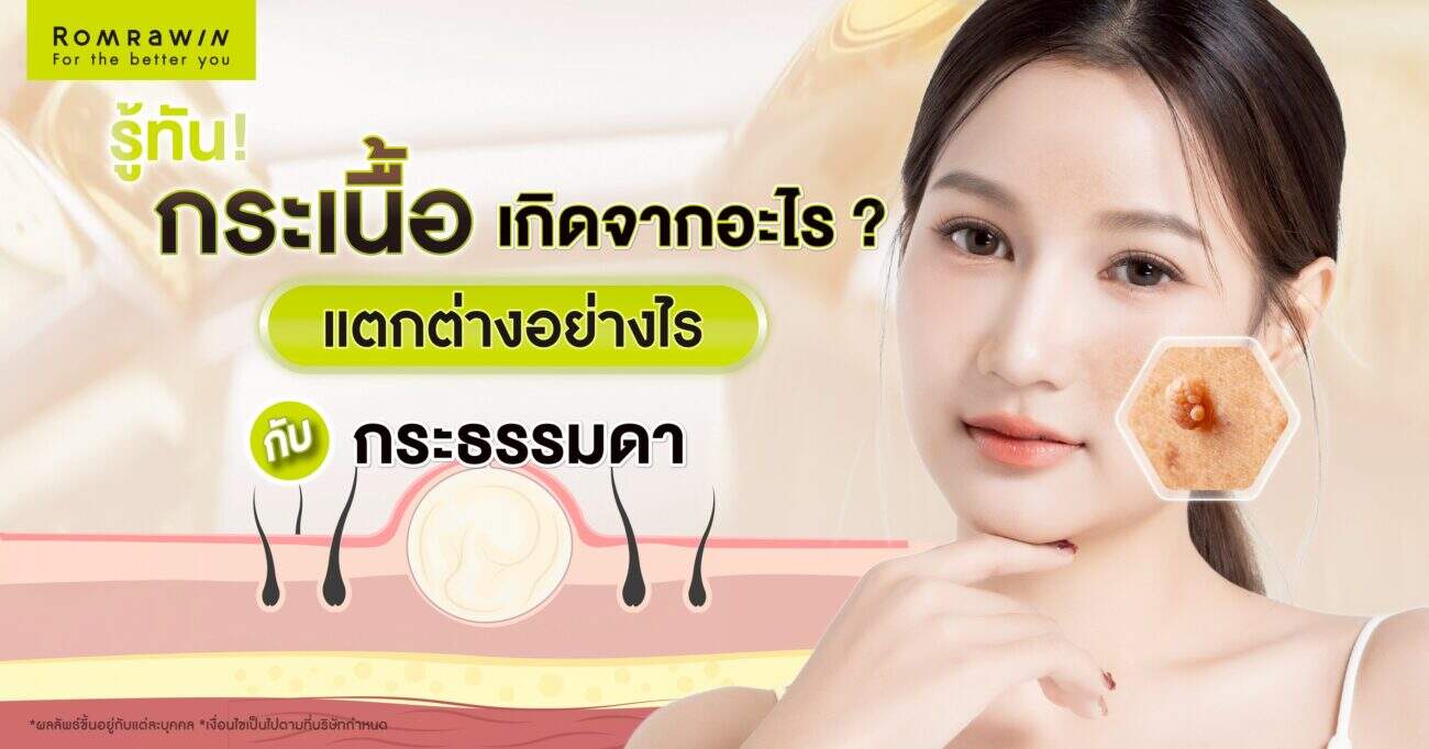 กระเนื้อ