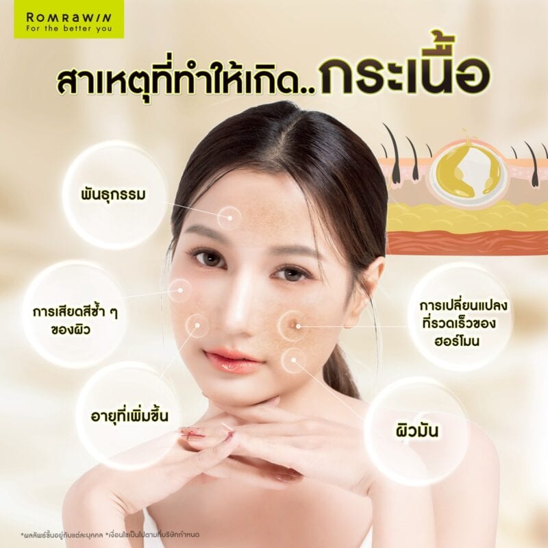 สาเหตุที่ทำให้เกิดกระเนื้อ