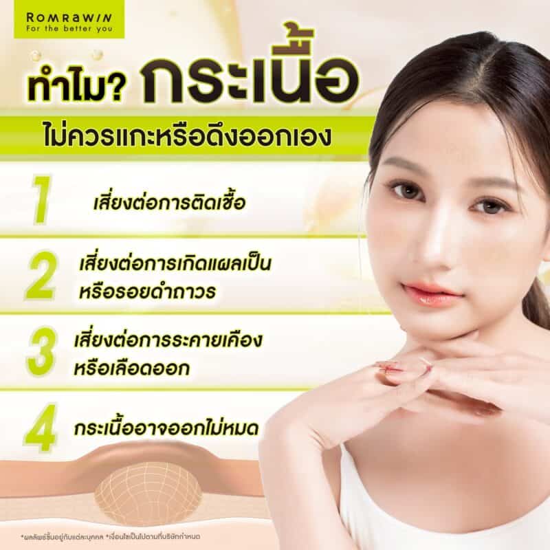 ทำไมกระเนื้อไม่ควรแกะหรือดึงออกเอง