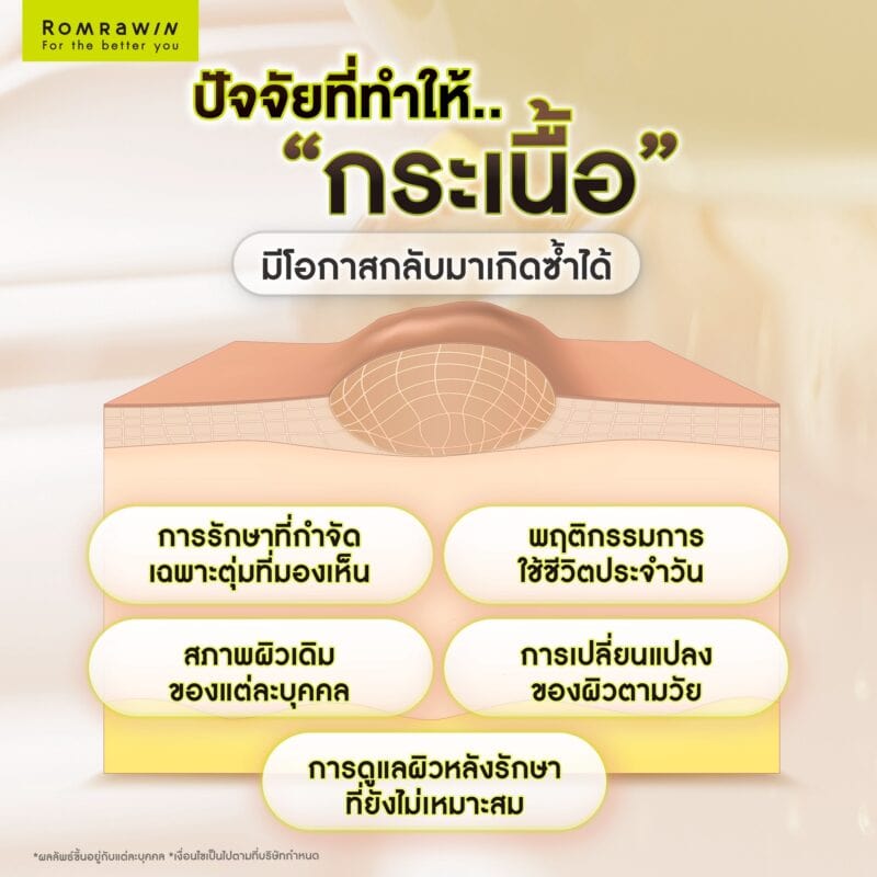 ปัจจัยที่ทำให้กระเนื้อมีโอกาสกลับมาเกิดซ้ำได้