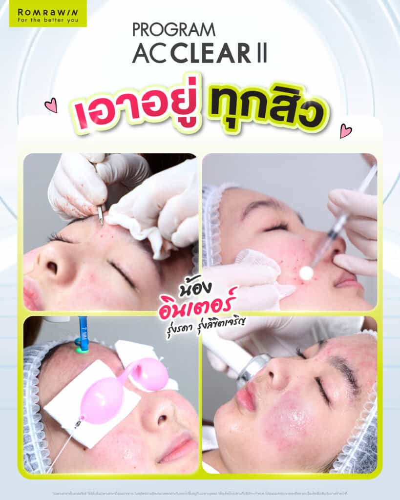 ผลลัพธ์ขึ้นอยู่กับแต่ละบุคคล