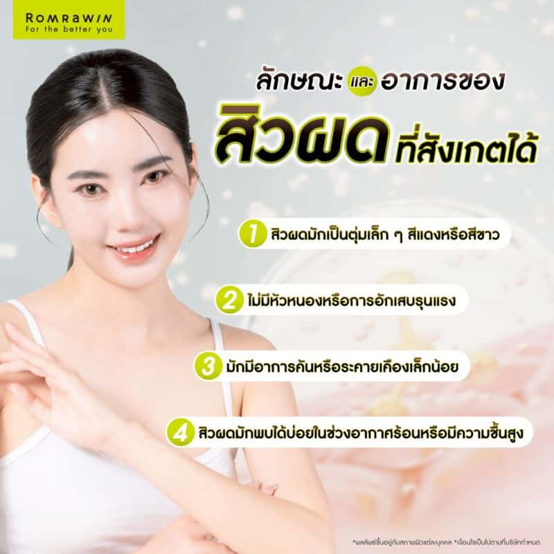 ลักษณะและอาการของสิวผดที่สังเกตได้