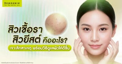 สิวเชื้อรา สิวยีสต์