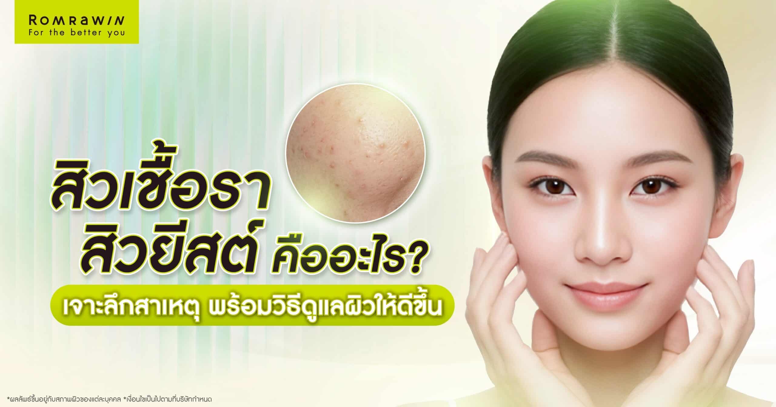 สิวเชื้อรา สิวยีสต์