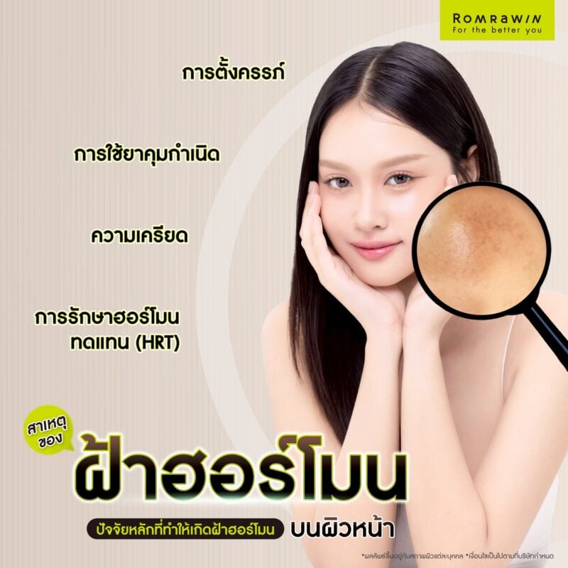 สาเหตุของฝ้าฮอร์โมน ปัจจัยหลักที่ทำให้เกิดฝ้าฮอร์โมนบนผิวหน้า
