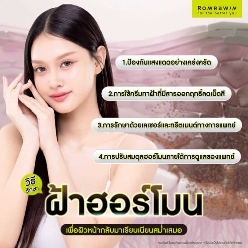 วิธีรักษาฝ้าฮอร์โมน เพื่อผิวหน้ากลับมาเรียบเนียนสม่ำเสมอ