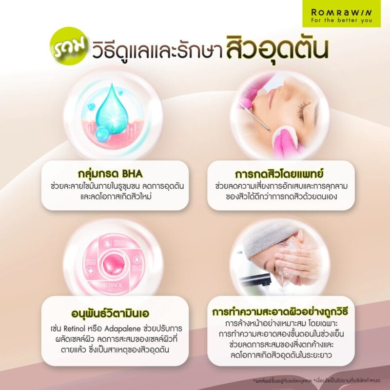 รวมวิธีดูแลและรักษาสิวอุดตัน