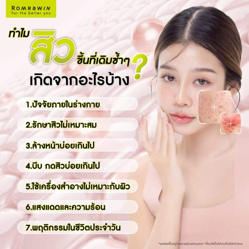 ทำไมสิวขึ้นที่เดิมซ้ำๆ เกิดจากอะไรบ้าง?