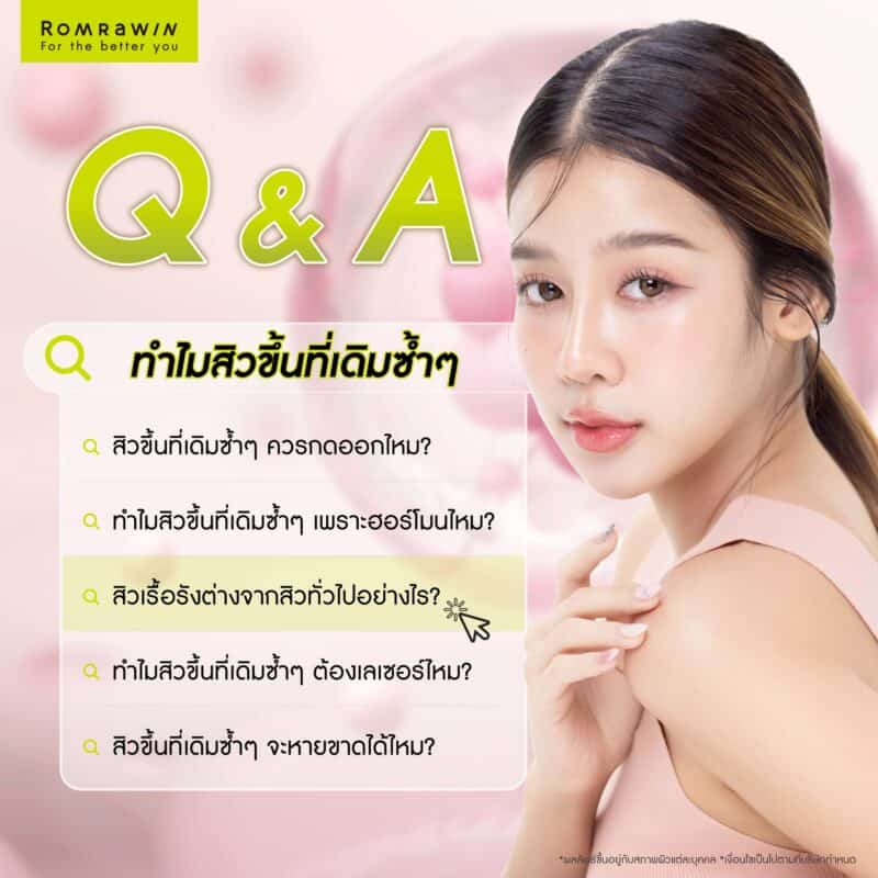 คำถามที่พบบ่อยเกี่ยวกับทำไมสิวขึ้นที่เดิมซ้ำๆ