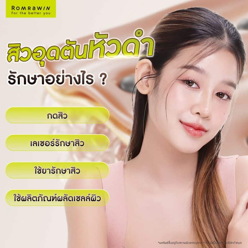 สิวอุดตันหัวดำรักษาได้อย่างไร?