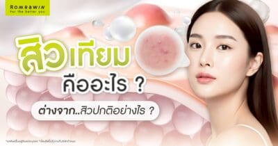 สิวเทียม