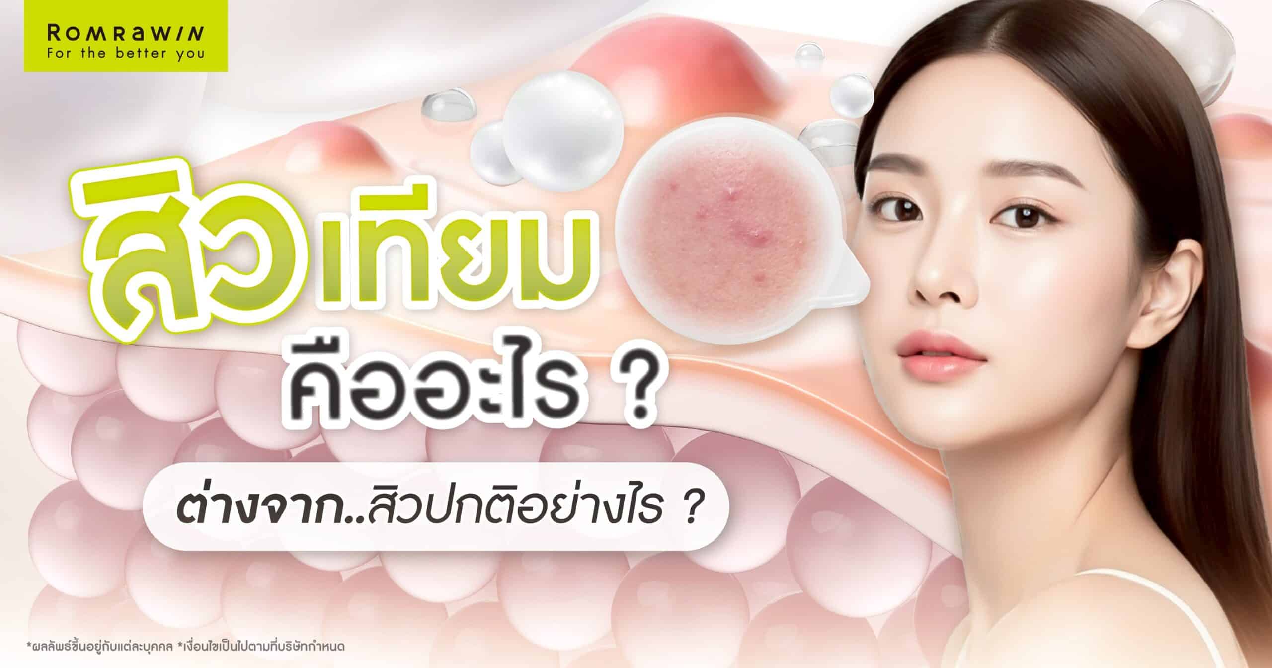 สิวเทียม