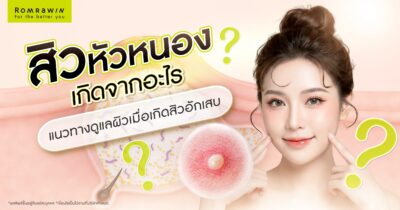 สิวหัวหนอง เกิดจาก