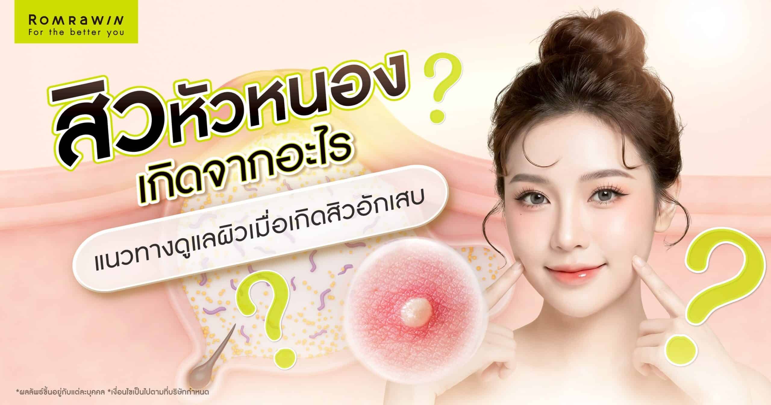 สิวหัวหนองเกิดจาก