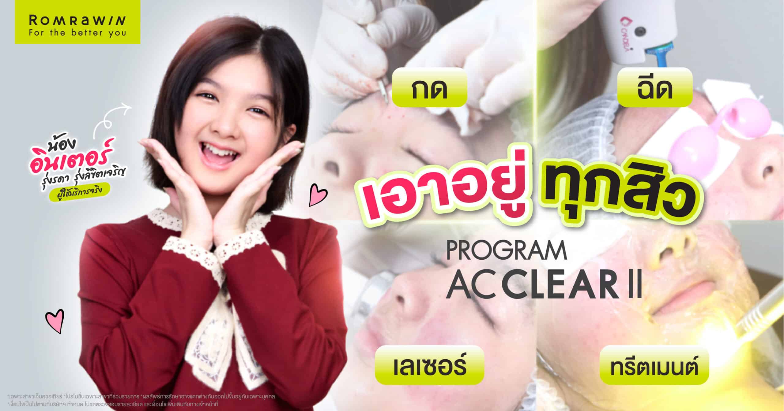 โปรแกรม AC CLEAR II ช่วยน้องอินเตอร์ให้หน้าใส เอาอยู่ทุกสิว