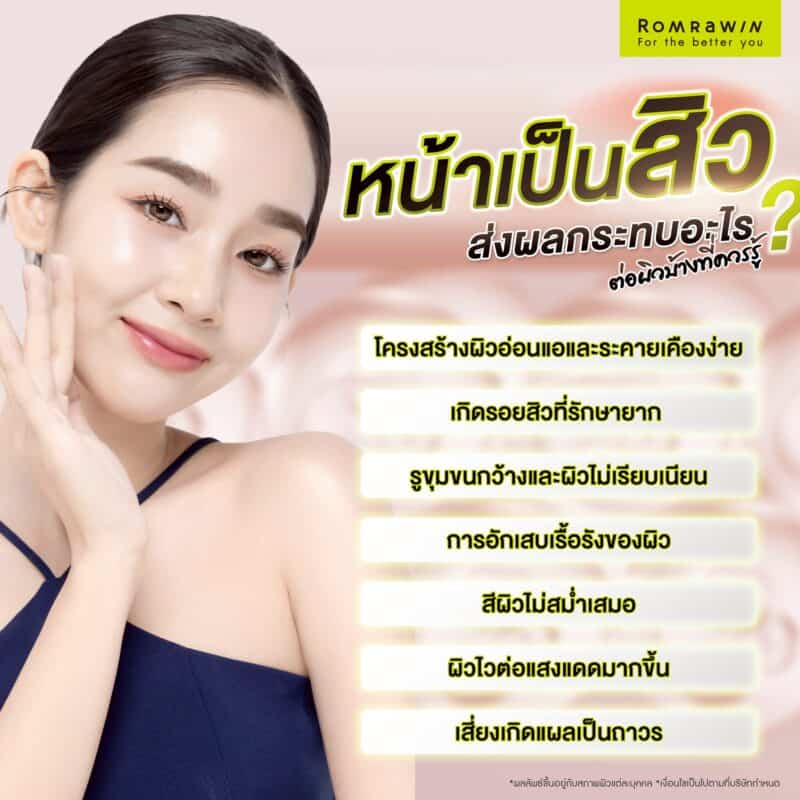 หน้าเป็นสิว ส่งผลกระทบต่ออะไรกับผิวบ้าง