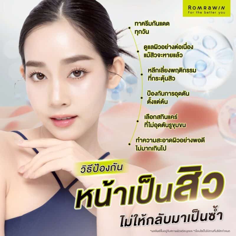 วิธีป้องกันหน้าเป็นสิวไม่ให้กลับมาเป็นซ้ำ 