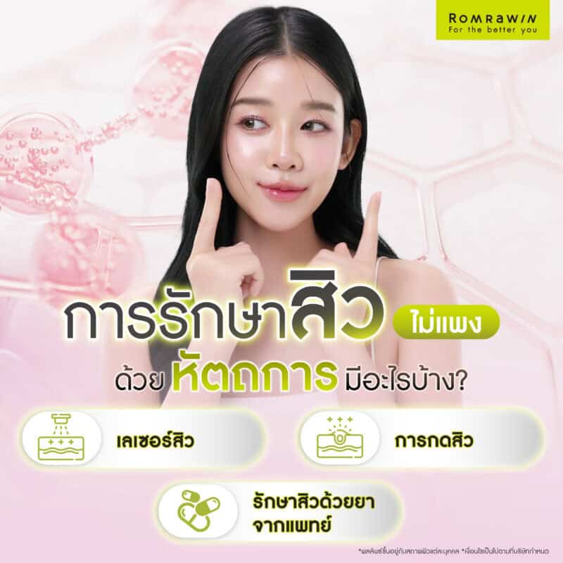 การรักษาสิวไม่แพงด้วยหัตถการมีอะไรบ้าง?