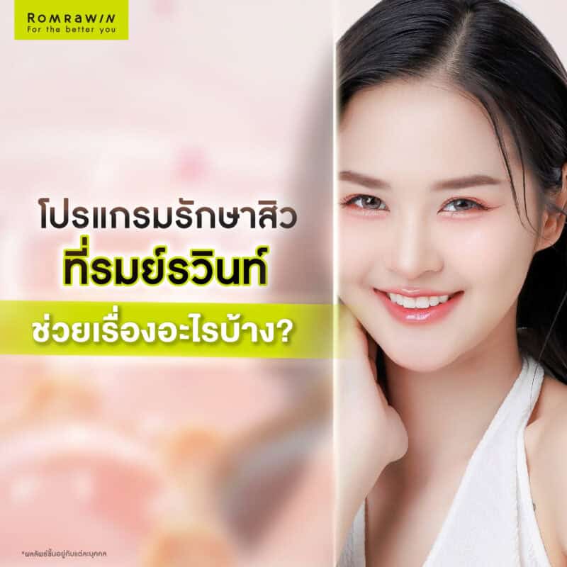 โปรแกรมรักษาสิวที่รมย์รวินท์คลินิกช่วยเรื่องอะไรบ้าง?