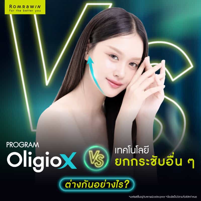 เปรียบเทียบ Oligio X กับ เทคโนโลยียกกระชับอื่น ๆ