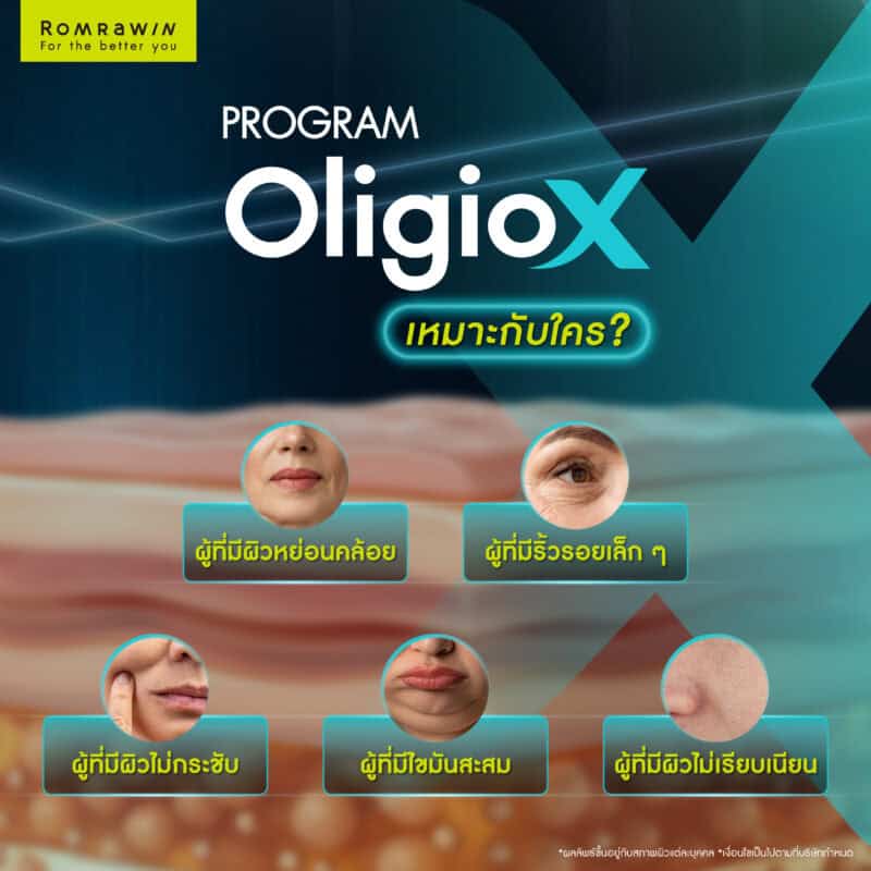 Oligio X เหมาะกับใคร?