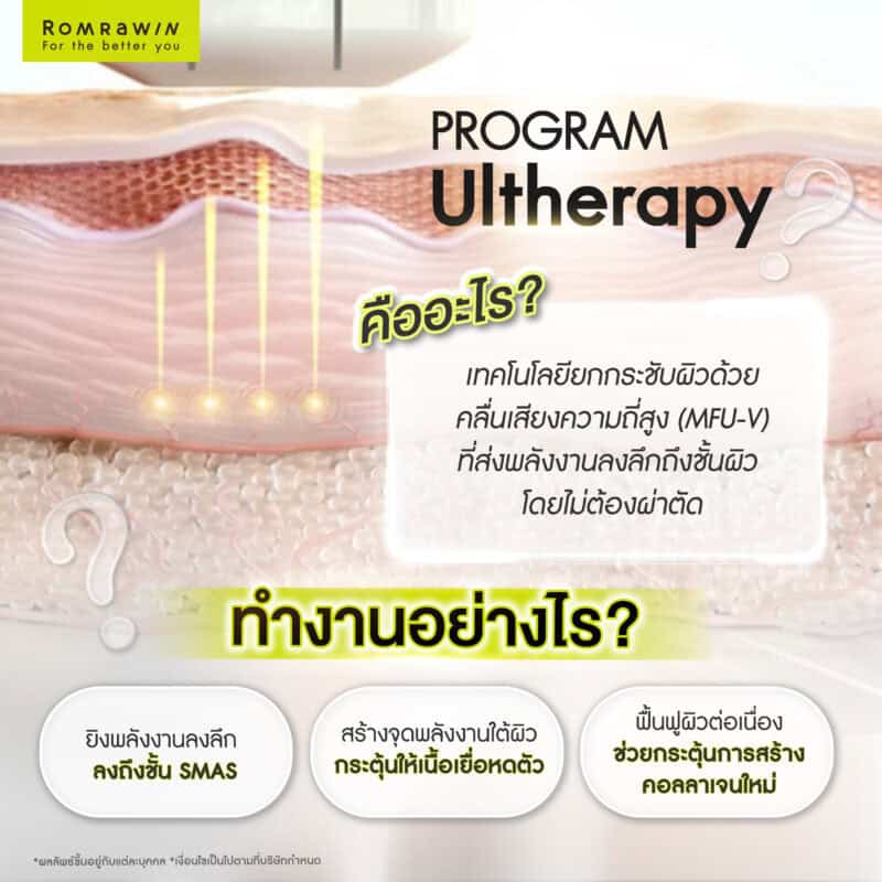 Ultherapy คืออะไร? 