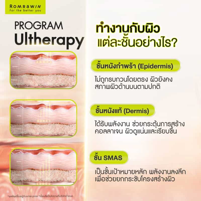 Ultherapy กับการเปลี่ยนแปลงของผิวในแต่ละชั้น
