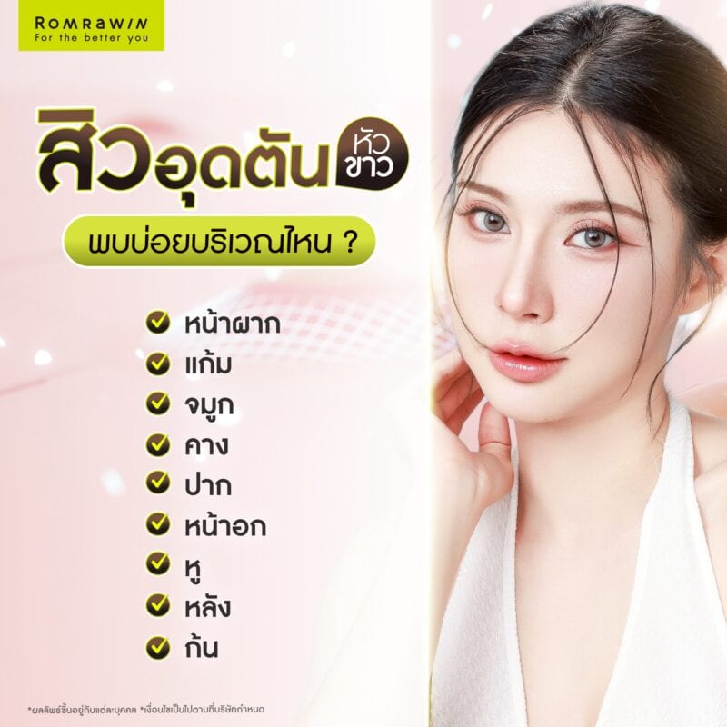 สิวอุดตันหัวขาวพบบ่อยบริเวณไหน?