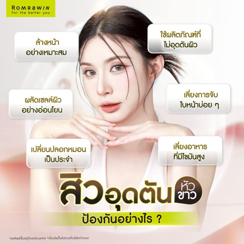 สิวอุดตันหัวขาวป้องกันได้อย่างไร?