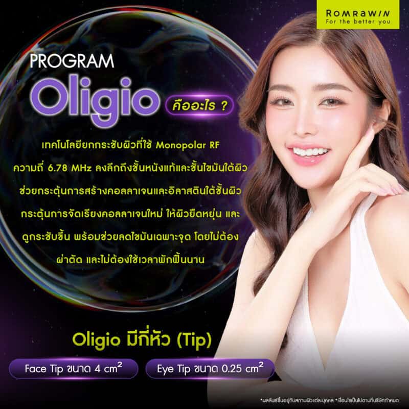 Oligio คืออะไร 