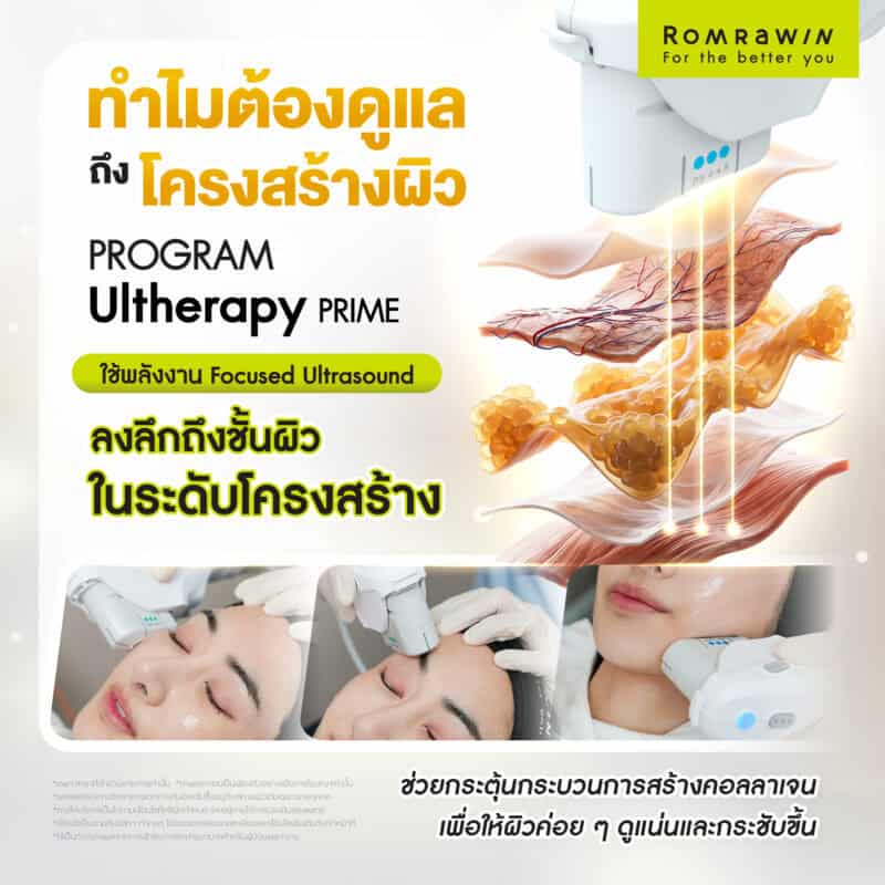 ผลลัพธ์ขึ้นอยู่กับแต่ละบุคคล