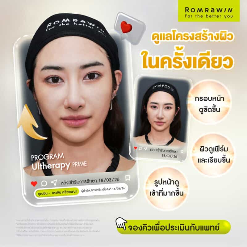 ผลลัพธ์ขึ้นอยู่กับแต่ละบุคคล