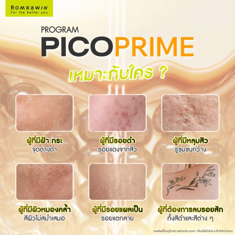 Pico Prime เหมาะกับใคร