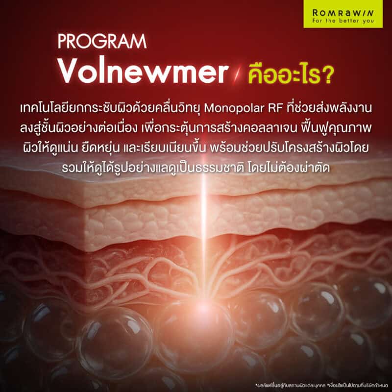 โปรแกรม Volnewmer คืออะไร?