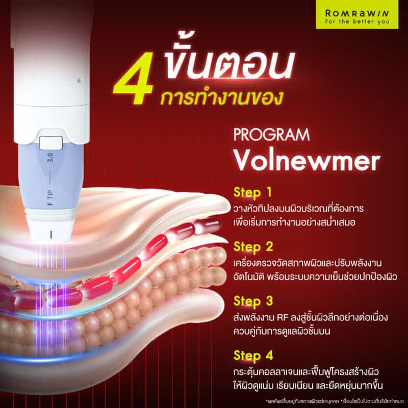 4 ขั้นตอนการทำงานของโปรแกรม Volnewmer