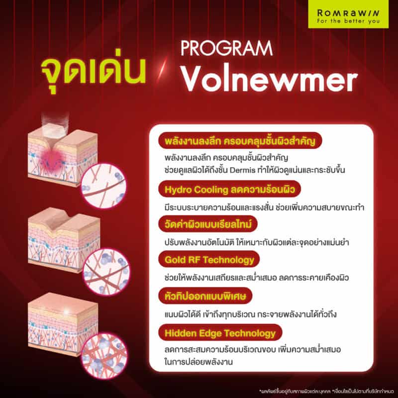 จุดเด่นของโปรแกรม Volnewmer ที่ทำให้แตกต่าง