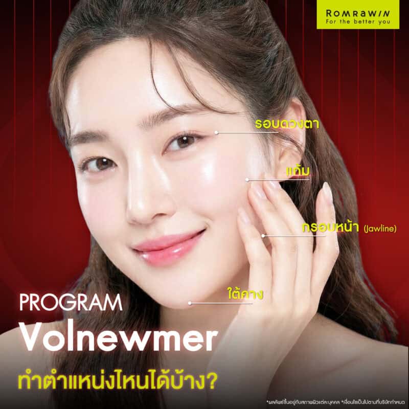 โปรแกรม Volnewmer ทำตำแหน่งไหนได้บ้าง?
