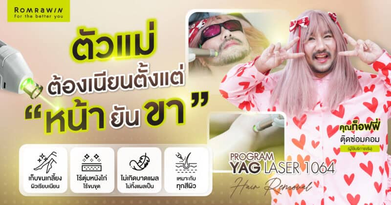 จัดระเบียบหนวดให้คุณท็อฟฟี่มั่นใจ ไม่มีรก ด้วยโปรแกรม YAG LASER 1064